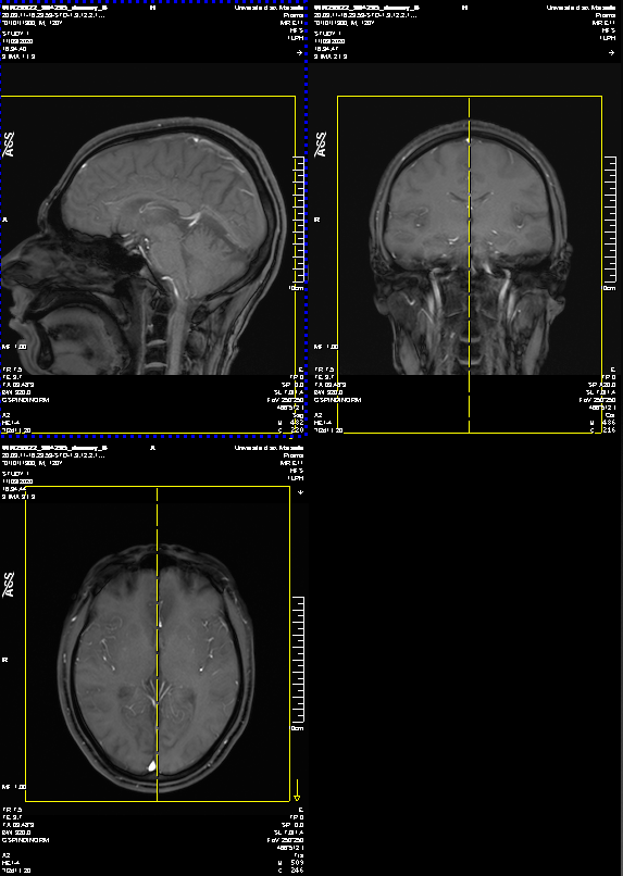 Launching the MRI acquistion – Centre IRM – INT